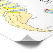 Spinale degeneratieschijfherniatie Poster (Hoek)