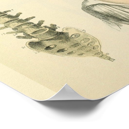 Spinale kolom Vertebrae Anatomie Art Afdrukken Poster (Hoek)