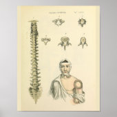 Spinale kolom Vertebrae Anatomie Art Afdrukken Poster (Voorkant)
