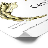 Spinale zenuwen Chiropractische subluxaties Poster (Hoek)