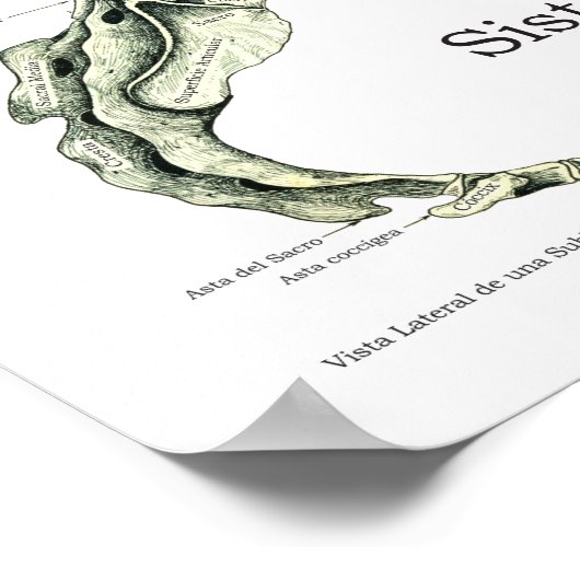 Spinale zenuwen Subluxe Chiropraktijk Poster (Hoek)