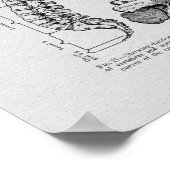 Spine and Vertebrae Vintage Print (Hoek)