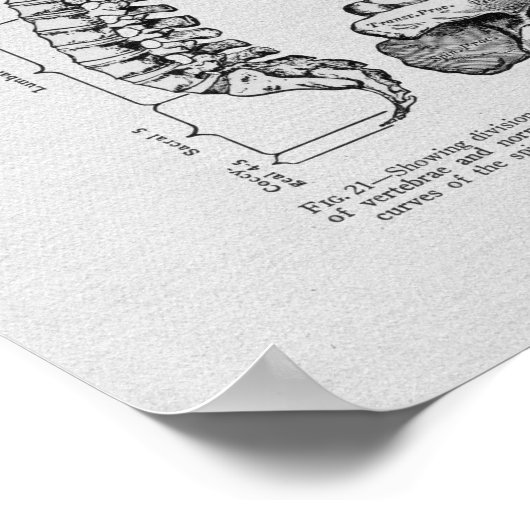 Spine and Vertebrae Vintage Print (Hoek)