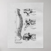 Spine and Vertebrae Vintage Print (Voorkant)