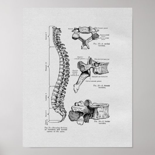 Spine and Vertebrae Vintage Print (Voorkant)