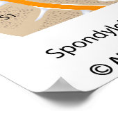 Spondylolysis and spondylolisthesis, labeled poster (Hoek)