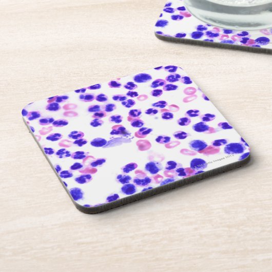 Staph-infectie Drankjes Onderzetter (Linkerzijde)