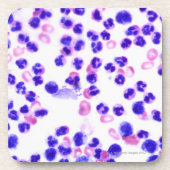 Staph-infectie Drankjes Onderzetter (Voorkant)