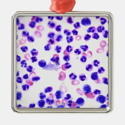 Staph-infectie Metalen Ornament (Voorkant)