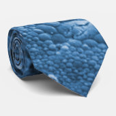 Stargardt disease stropdas (Opgerold)