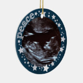 Stars en Joy. Sonogram First Kerstversiering Keramisch Ornament (Rechts)