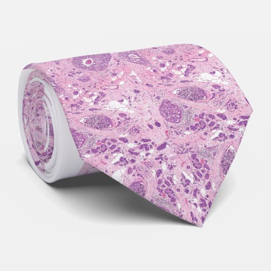 stropdas - Borstkanker Cellen (Opgerold)