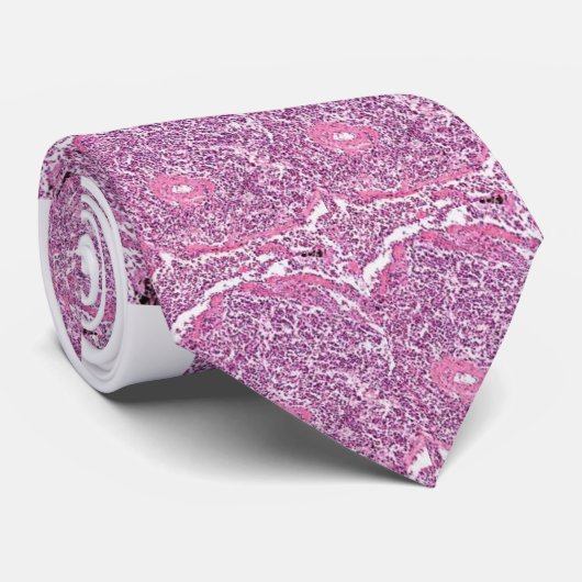 stropdas - Lung Cancer Cells (Opgerold)