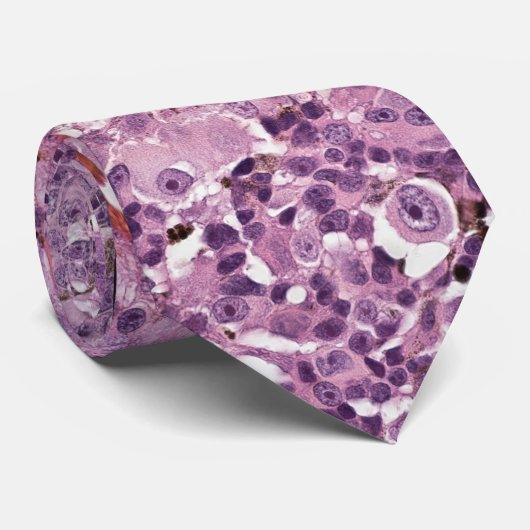 Stropdas met uvea melanoom (Opgerold)