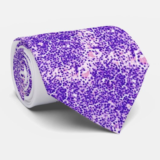 stropdas - multipel myeloom (Opgerold)