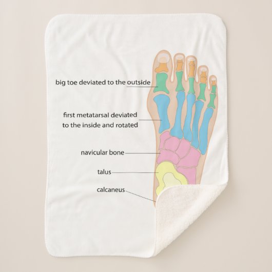 Structuur van de menselijke voet sherpa deken (Voorkant)