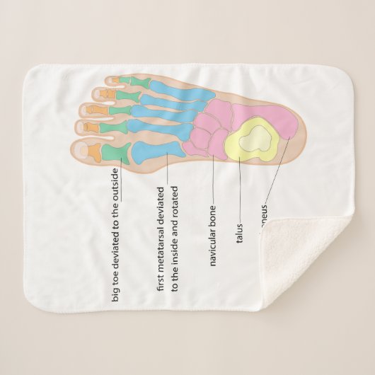 Structuur van de menselijke voet sherpa deken (Voorkant (horizontaal))