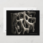 Structuur van een bot met osteoporose briefkaart (Voorkant / Achterkant)