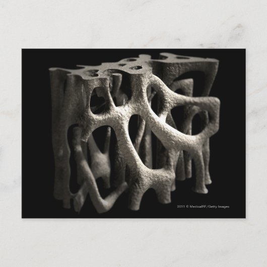 Structuur van een bot met osteoporose briefkaart (Voorkant)