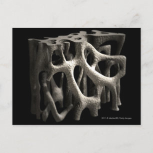 Structuur van een bot met osteoporose briefkaart