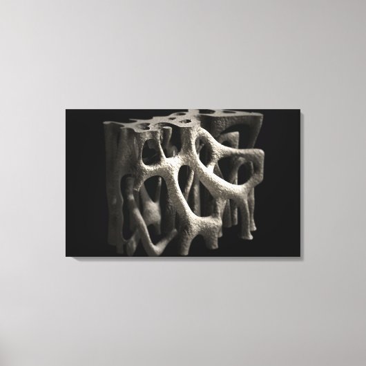 Structuur van een bot met osteoporose canvas afdruk (Voorkant)