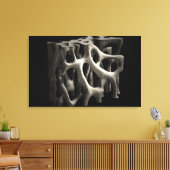 Structuur van een bot met osteoporose canvas afdruk (Insitu (Woonkamer))