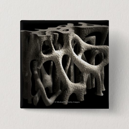 Structuur van een bot met osteoporose vierkante button 5,1 cm (Voorkant)