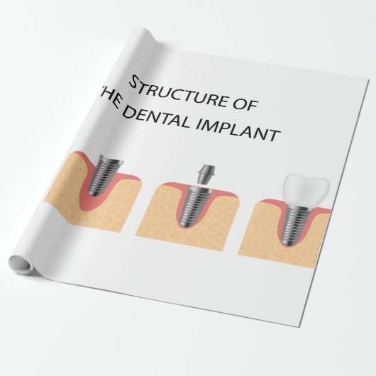 Structuur van het tandheelkundig implantaat cadeaupapier (Uitgerold)