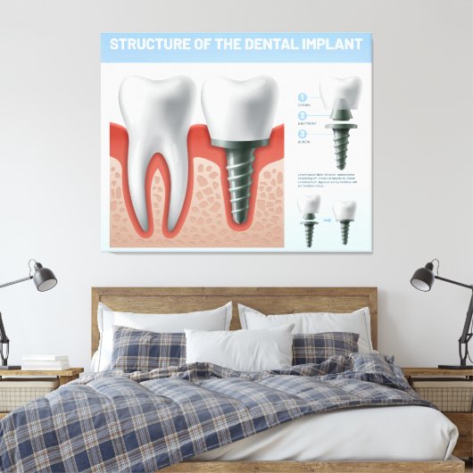 Structuur van het tandheelkundig implantaat canvas afdruk (Insitu (Slaapkamer))