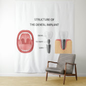 Structuur van tandheelkundig implantaat wandkleed (In situ)