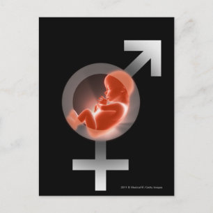 Superopgelegde foetus boven mannelijke en vrouw sy briefkaart