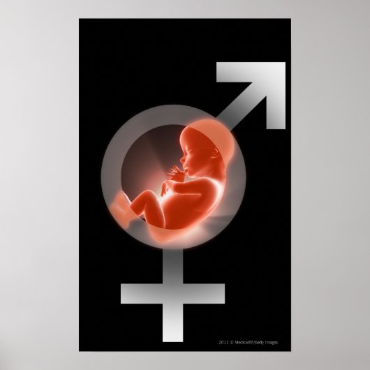 Superopgelegde foetus boven mannelijke en vrouw sy poster (Voorkant)