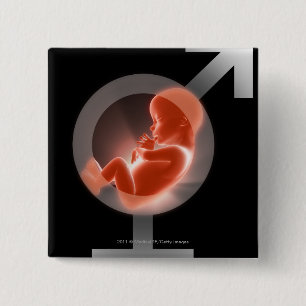 Superopgelegde foetus boven mannelijke en vrouw sy vierkante button 5,1 cm