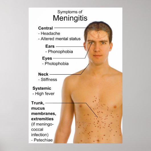 Symptomen Grafiek van ontsteking Meningitis Poster (Voorkant)