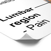 Symptomen van acute hemolytische transfusiereactie poster (Hoek)