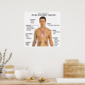 Symptomen van acute hemolytische transfusiereactie poster (Keuken)