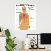 Symptoomdiagram van systemische lupus Erythematosu Poster (Thuiskantoor)