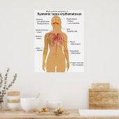 Symptoomdiagram van systemische lupus Erythematosu Poster (Keuken)