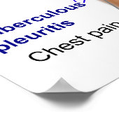 Symptoomgrafiek van tuberculose bij de mens poster (Hoek)