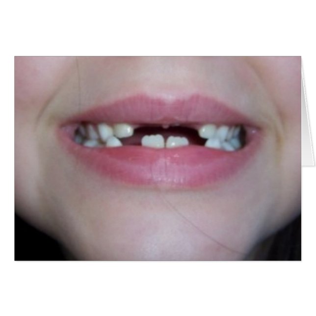 tand (Voorkant Horizontaal)