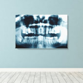 Tand-röntgenfoto Canvas Afdruk (Insitu (Houten vloer))