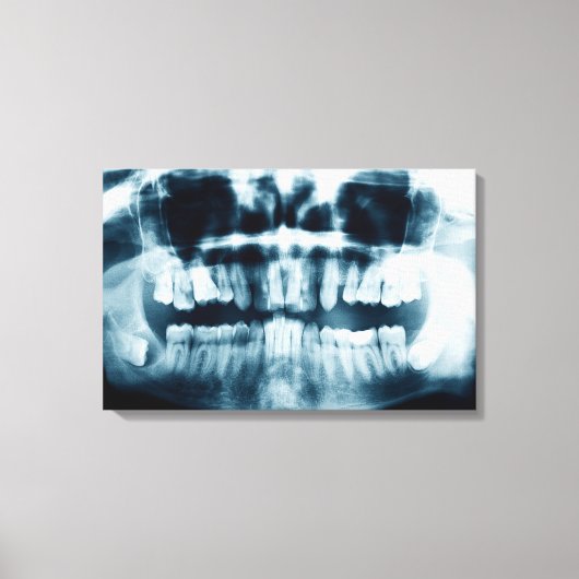 Tand-röntgenfoto Canvas Afdruk (Voorkant)