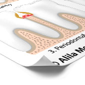 Tandaandoening Periodontale Poster (Hoek)