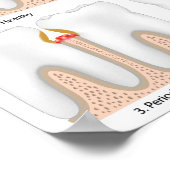 Tandaandoening Periodontale Poster (Hoek)