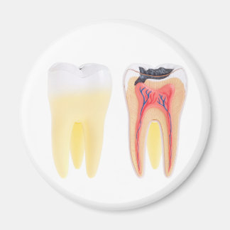 Tanden Anatomie Magneet
