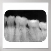 Tanden met vulling poster (Voorkant)