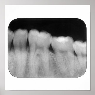 Tanden met vulling poster