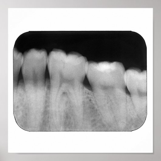 Tanden met vulling poster (Voorkant)