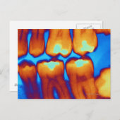 Tanden met vullingen (groen), gekleurde röntgenfot briefkaart (Voorkant / Achterkant)