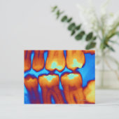 Tanden met vullingen (groen), gekleurde röntgenfot briefkaart (Staand voorkant)